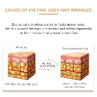 סרום רטינול לטיפול בסימני הזדקנות מסביב לעיניים