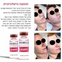 חומצה-היאלורונית-טיפול-פנים