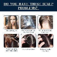 סרום לטיפול ומניעת קשקשים בשיער