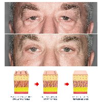 קרם עיניים טיפולי להרמה, הלבנה ושיקום מראה העור