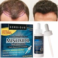 מינוקסידיל-תכשיר-לצמיחת-השיער (2)