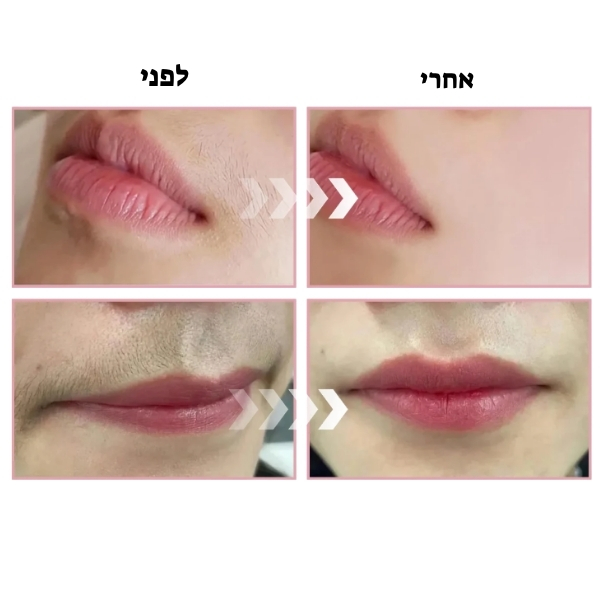 ערכת-דרמפלאנינג-מבית-Dermaplaning-להסרת-שיער-מהפנים