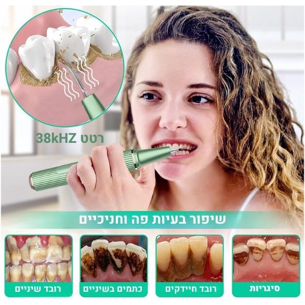 ניקוי-אבנית-בשיניים-מכשיר-לבית