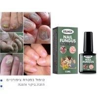 לק-ציפורניים-פטרת
