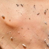 ג'ל פילינג עדין להבהרה וניקוי העור – GlowPeel