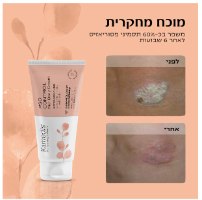 קרם גוף טיפולי לעור אדמומי, מגורה ומתקלף - PSO SKIN BODY CREAM