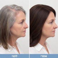 ערכה-לכיסוי-צביעת-שורשים-מהיר-עמיד-יום-שלם-לפני-ואחרי-דוגמא