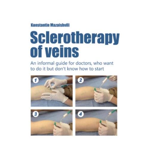 Sclerotherapy of veins: An informal guide for doctors who want to do it but don't know how to start