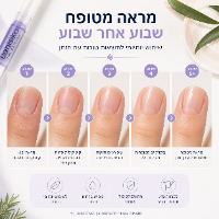 עט שמן הזנה לטיפוח הציפורן