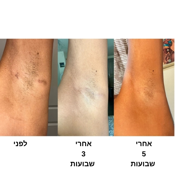 סבון כורכום ולימון טיפולי להבהרת פיגמנטציה ואיזון העור Skin Turmeric