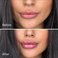 Lip boost - לשפתיים מלאות ועבות ברגע!