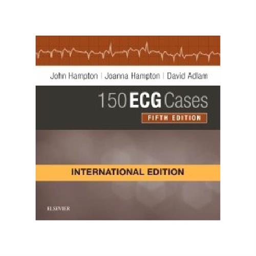 150 ECG Cases