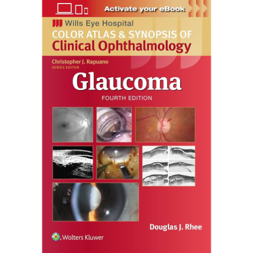 Glaucoma (Wills Eye Institute Atlas Series)