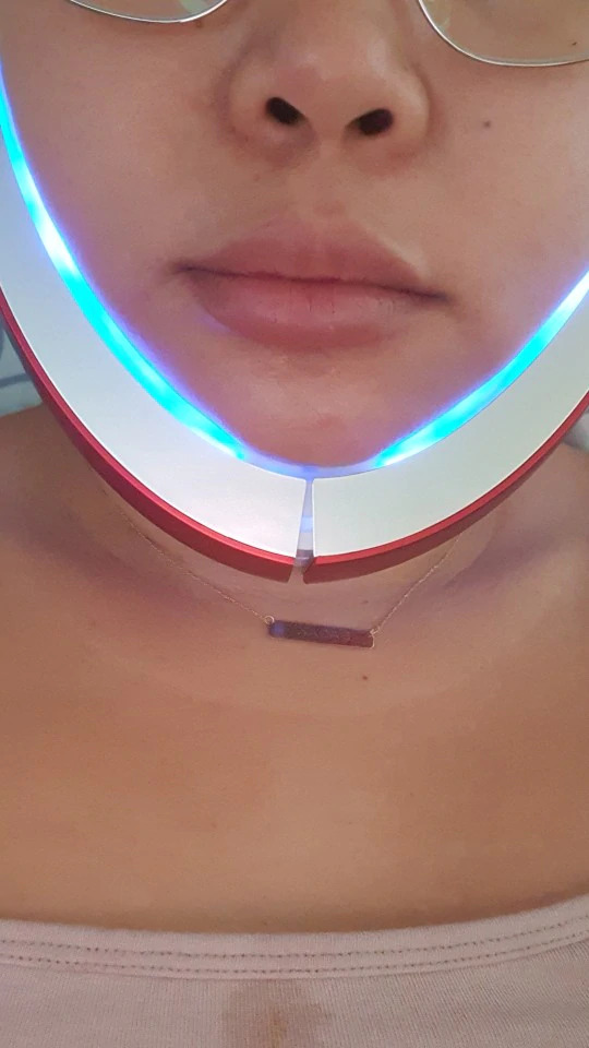 חוות דעת - מזותרפיה להרמת הצוואר והסנטר - Techno therapy