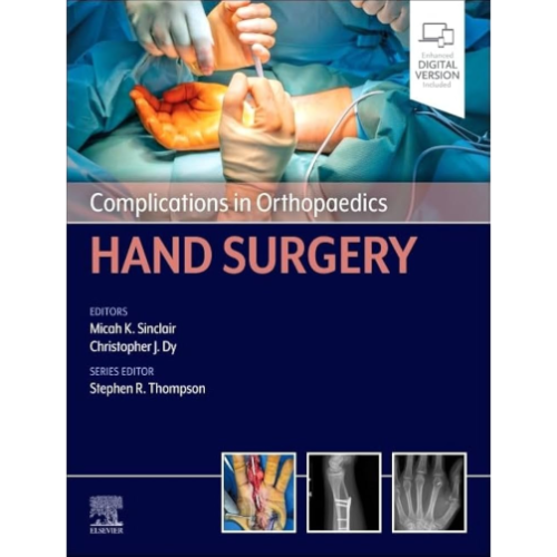 Complications in Orthopaedics: Hand Surgery