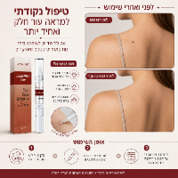 תכשיר ג'ל להסרת יבלות ושומות