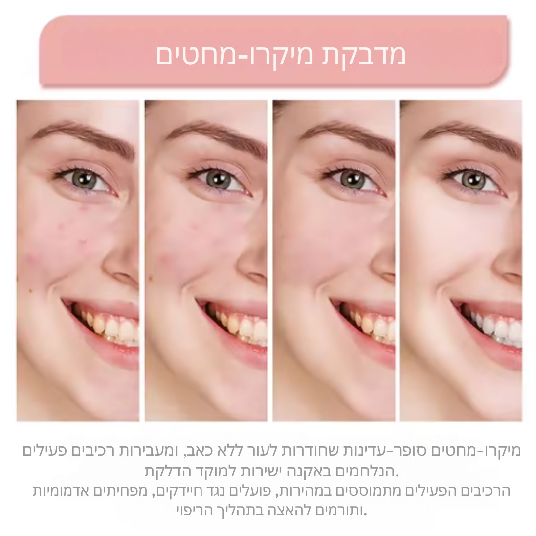 Acne Care Patches – פאצ'ים בלתי נראים לטיפול באקנה