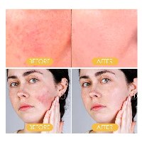 אבקת מקדם הגנה מהשמש SPF50 שקופה