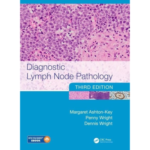 Diagnostic Lymph Node Pathology 3rd Edition