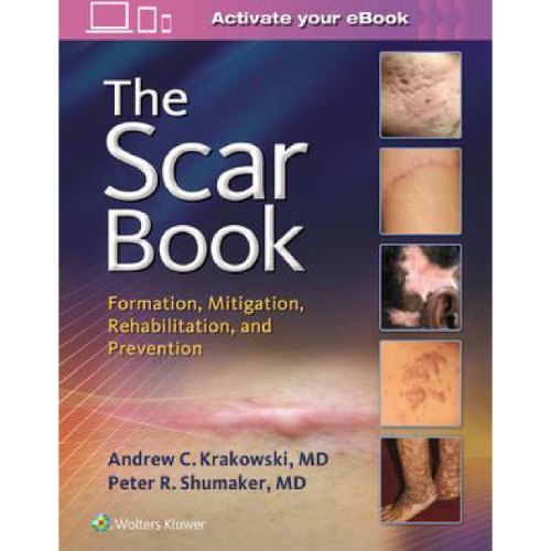 The Scar Book : Formation, Mitigation, Rehabilitation and Preventio