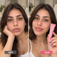 שפתון טיפולי המעניק הזנה עמוקה ואפקט ברק זכוכיתי מבית Medicube PDRN Peptide