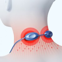 injury -מכשיר EMS לעיסוי לימפטי בצוואר המעודד הרזיה והקלה על כאבים