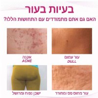 קרם-טיפול-אקנה-פצעונים-פצעוני-ישבן-ירך-נשים