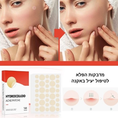 מדבקות הפלא לטיפול באקנה וחצ׳קונים Hydrocolloid