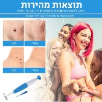 מכשיר-ידני-מסיר-שומות-עור