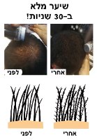 ערכה מקצועית להסוואת שיער דליל
