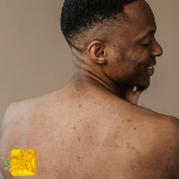 PA soap - סבון גוף מוצק לטיפול באקנה