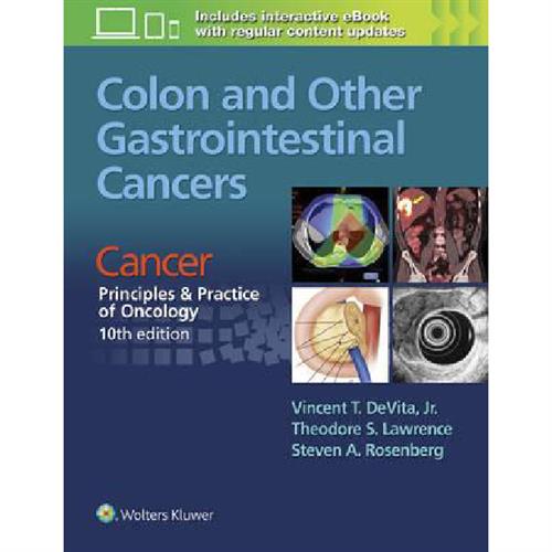 Colon and Other Gastrointestinal Cancers : Cancer: Principles & Practice of Oncology