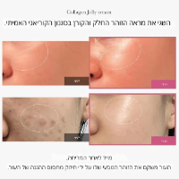 מסכת ג'לי קולגן