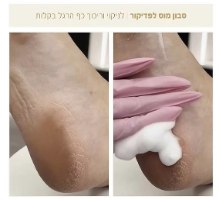 סבון מוס לטיפול פדיקור PLIE