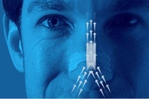 מדבקות למניעת נחירות Breathe right לעור רגיש.
