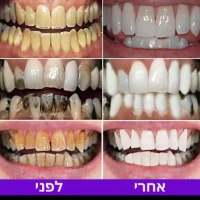 סרטי-הלבנת-שיניים-סגולים-2