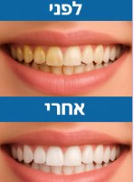 ידית דנטלית לניקוי אבנית מהשיניים