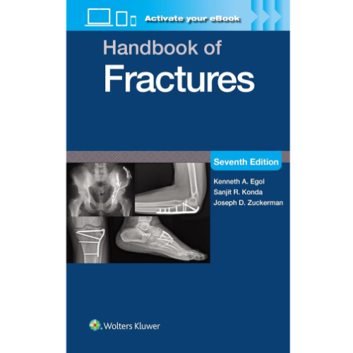 Handbook of Fractures