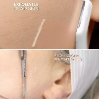 Dermaplanning - מכשיר פילינג לניקוי וחידוש העור