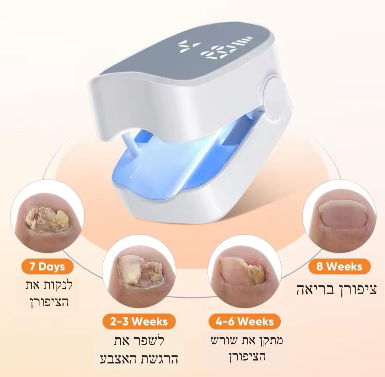 מנורת UV לטיפול בפטרת ציפורניים