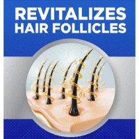מינוקסידיל קצף 5% לגבר – 1 חודשים | Minoxidil Foam Kirkland ב149 שח בלבד!