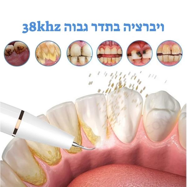 ניקוי-אבנית-בשיניים-מכשיר