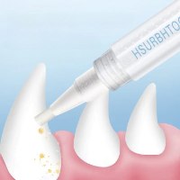 עט חדשני לניקוי והלבנת שיניים לחיות המחמד  - DentalPet