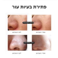פנים-עור-יובש