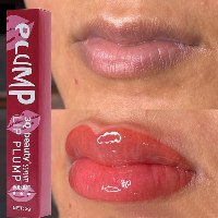 PLUMP - סרום מרוכז לניפוח שפתיים