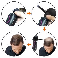ערכה מקצועית להסוואת שיער דליל