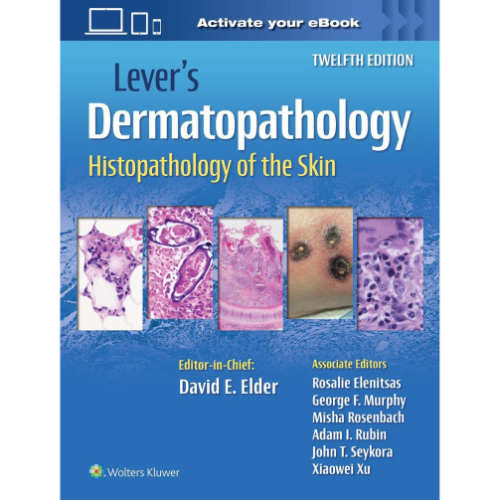 Lever's Histopathology of the Skin