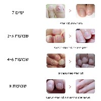 Magic stickers-מדבקות ג'ל לטיפול בפטרת