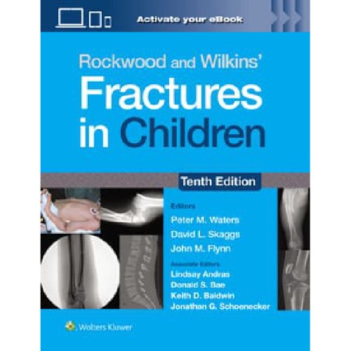 Rockwood and Wilkins Fractures in Children