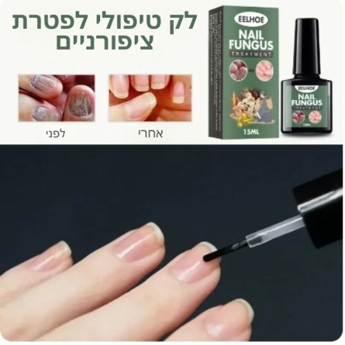 נוזל לק טיפולי לפטרת ציפורניים NailFungus